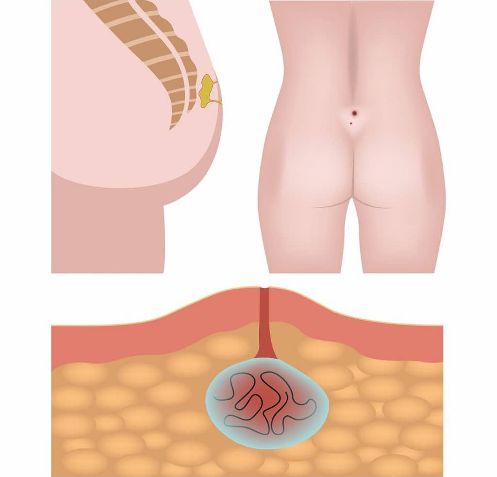 ΚΥΣΤΗ ΚΟΚΚΥΓΟΣ ΦΩΤΟΓΡΑΦΙΕΣ