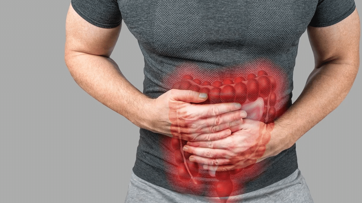 Βουβωνοκήλη και Χρόνος Ανάρρωσης Μετά Το Χειρουργείο